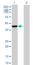 Western blot - Anti-Cathepsin E antibody (AB89414)