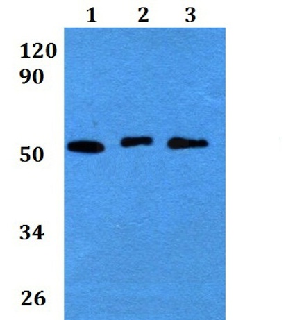 Western blot - Anti-Cathepsin F antibody (AB200650)