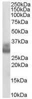 Western blot - Anti-Cathepsin F antibody (AB36161)