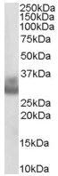 Western blot - Anti-Cathepsin F antibody (AB36161)