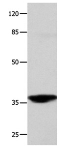 Western blot - Anti-Cathepsin G antibody (AB197354)