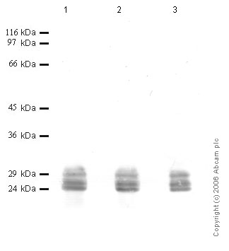 Western blot - Anti-Cathepsin G antibody (AB49854)
