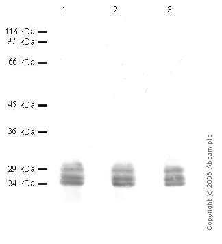 Western blot - Anti-Cathepsin G antibody (AB49854)