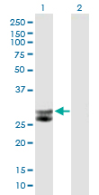 Western blot - Anti-Cathepsin G antibody (AB89593), expandable thumbnail