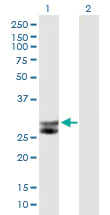 Western blot - Anti-Cathepsin G antibody (AB89593)