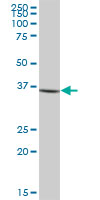 Western blot - Anti-Cathepsin G antibody (AB89593), expandable thumbnail