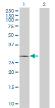Western blot - Cathepsin G overexpression 293T lysate (whole cell) (AB94086)