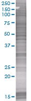 Cathepsin H overexpression 293T lysate (whole cell)