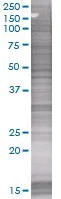 SDS-PAGE - Cathepsin H overexpression 293T lysate (whole cell) (AB94087)