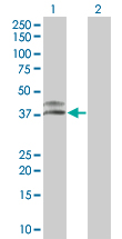 Western blot - Cathepsin H overexpression 293T lysate (whole cell) (AB94087)