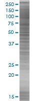 Cathepsin H overexpression 293T lysate (whole cell)