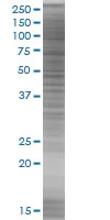 SDS-PAGE - Cathepsin H overexpression 293T lysate (whole cell) (AB94088)