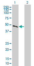Western blot - Cathepsin H overexpression 293T lysate (whole cell) (AB94088)