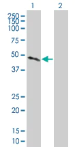 Western blot - Cathepsin H overexpression 293T lysate (whole cell) (AB94088)
