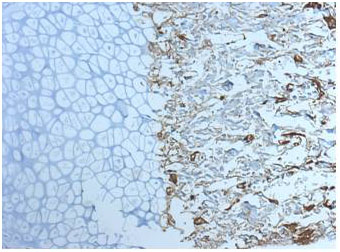 Immunohistochemistry (Formalin/PFA-fixed paraffin-embedded sections) - Anti-Cathepsin K antibody [3F9] (AB37259), expandable thumbnail