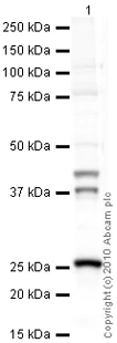 Western blot - Anti-Cathepsin K antibody [3F9] (AB37259)