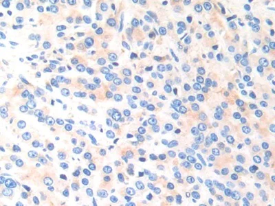 Immunohistochemistry (Formalin/PFA-fixed paraffin-embedded sections) - Anti-Cathepsin K antibody (AB231590)