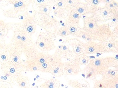 Immunohistochemistry (Formalin/PFA-fixed paraffin-embedded sections) - Anti-Cathepsin K antibody (AB231590)