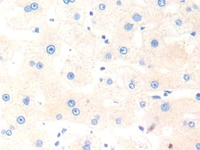 Immunohistochemistry (Formalin/PFA-fixed paraffin-embedded sections) - Anti-Cathepsin K antibody (AB231590)