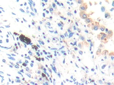 Immunohistochemistry (Formalin/PFA-fixed paraffin-embedded sections) - Anti-Cathepsin K antibody (AB231590)