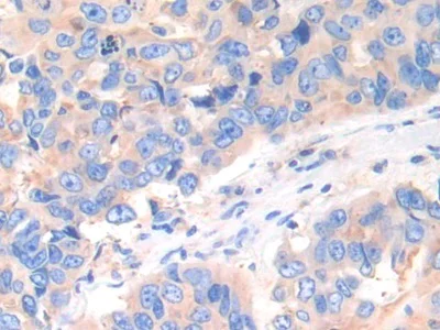 Immunohistochemistry (Formalin/PFA-fixed paraffin-embedded sections) - Anti-Cathepsin K antibody (AB231590)
