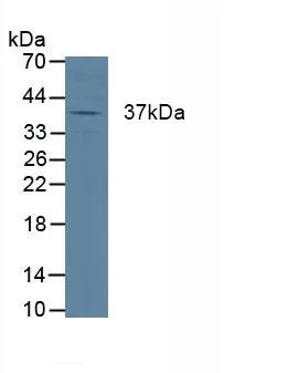 Western blot - Anti-Cathepsin K antibody (AB231590)
