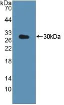 Western blot - Anti-Cathepsin K antibody (AB231590)