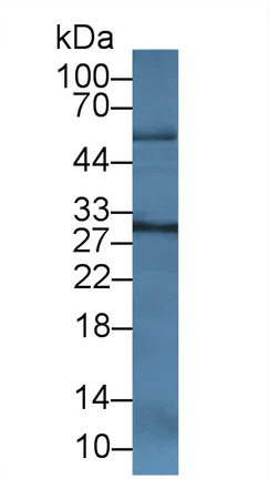Western blot - Anti-Cathepsin K antibody [C1] (AB239506)