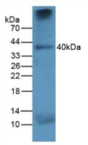 Western blot - Anti-Cathepsin K antibody [C1] (AB239506)