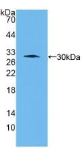 Western blot - Anti-Cathepsin K antibody [C1] (AB239506)