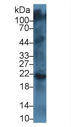 Western blot - Anti-Cathepsin K antibody [C1] (AB239506)