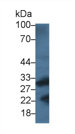 Western blot - Anti-Cathepsin K antibody [C1] (AB239506)