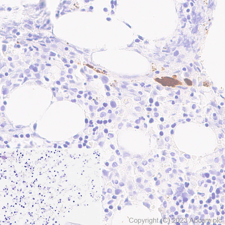 Immunohistochemistry (Formalin/PFA-fixed paraffin-embedded sections) - Anti-Cathepsin K antibody [EP9403] (AB187647)