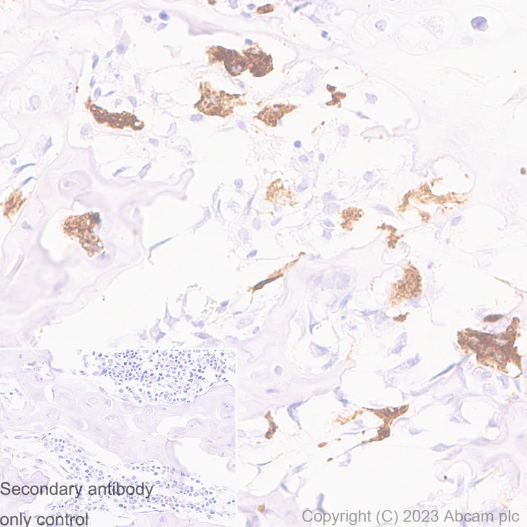 Immunohistochemistry (Formalin/PFA-fixed paraffin-embedded sections) - Anti-Cathepsin K antibody [EP9403] (AB187647)