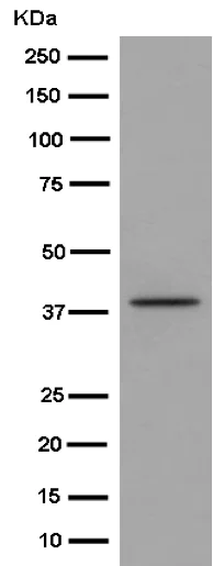 Western blot - Anti-Cathepsin K antibody [EP9403] (AB187647)