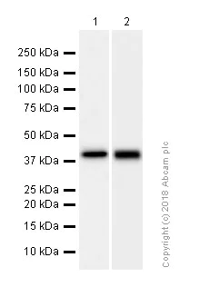 Western blot - Anti-Cathepsin K antibody [EP9403] (AB187647)