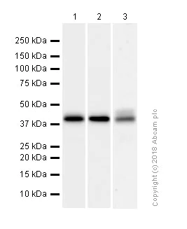 Western blot - Anti-Cathepsin K antibody [EP9403] (AB187647)
