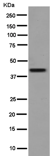 Western blot - Anti-Cathepsin K antibody [EP9403] (AB187647)