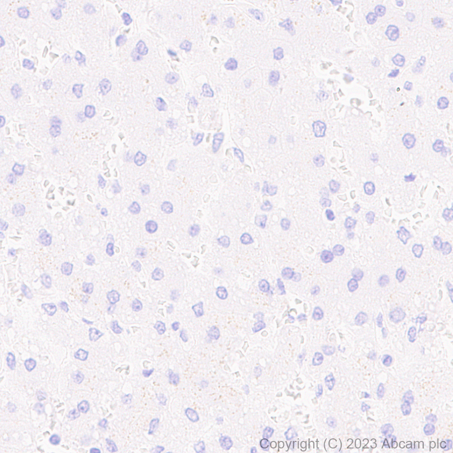Immunohistochemistry (Formalin/PFA-fixed paraffin-embedded sections) - Anti-Cathepsin K antibody [EP9403] - BSA and Azide free (AB240303)