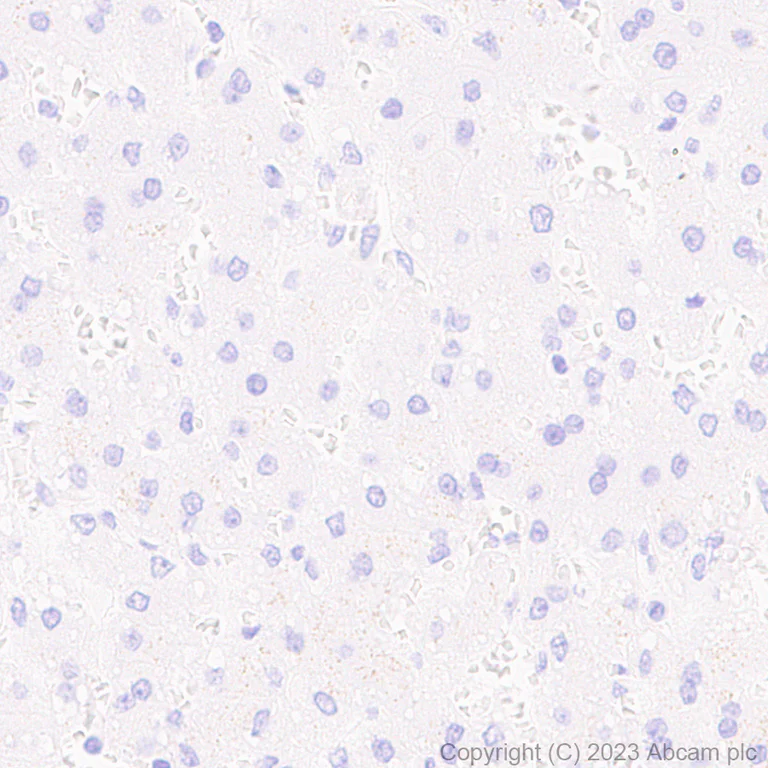 Immunohistochemistry (Formalin/PFA-fixed paraffin-embedded sections) - Anti-Cathepsin K antibody [EP9403] - BSA and Azide free (AB240303)