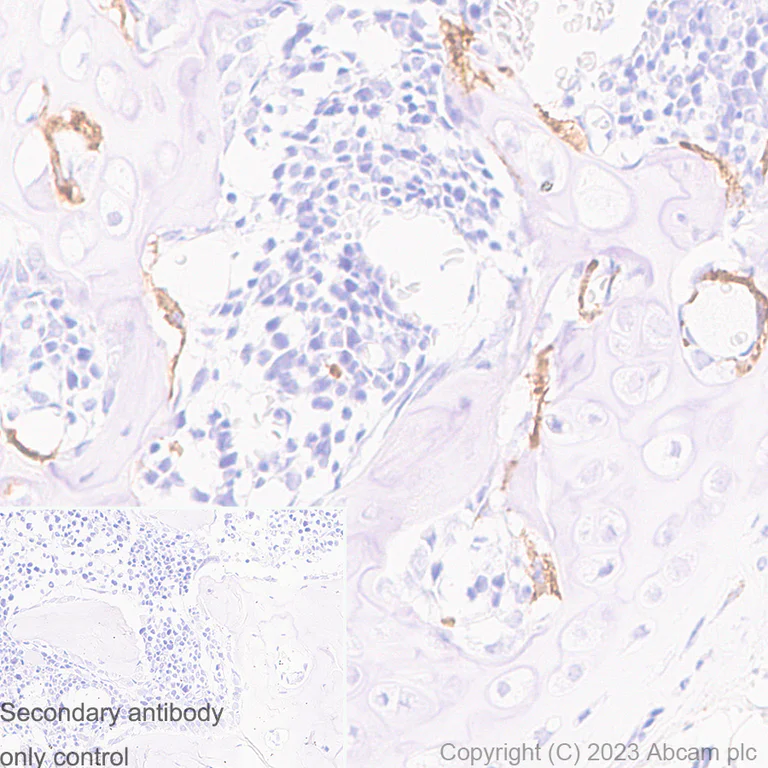 Immunohistochemistry (Formalin/PFA-fixed paraffin-embedded sections) - Anti-Cathepsin K antibody [EP9403] - BSA and Azide free (AB240303)