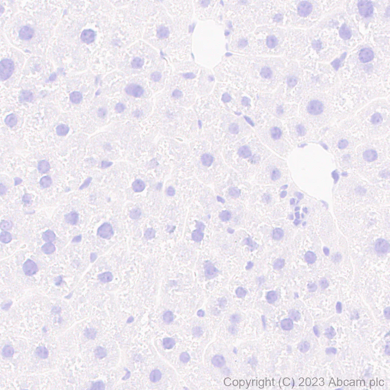 Immunohistochemistry (Formalin/PFA-fixed paraffin-embedded sections) - Anti-Cathepsin K antibody [EP9403] - BSA and Azide free (AB240303)