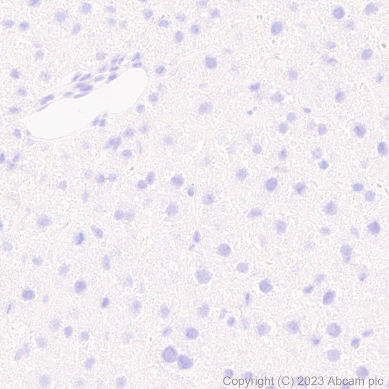 Immunohistochemistry (Formalin/PFA-fixed paraffin-embedded sections) - Anti-Cathepsin K antibody [EP9403] - BSA and Azide free (AB240303)