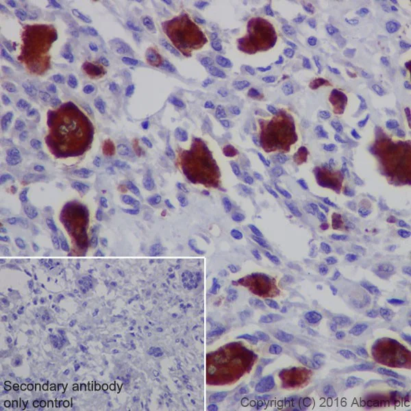Immunohistochemistry (Formalin/PFA-fixed paraffin-embedded sections) - Anti-Cathepsin K antibody [EPR19992] (AB207086)
