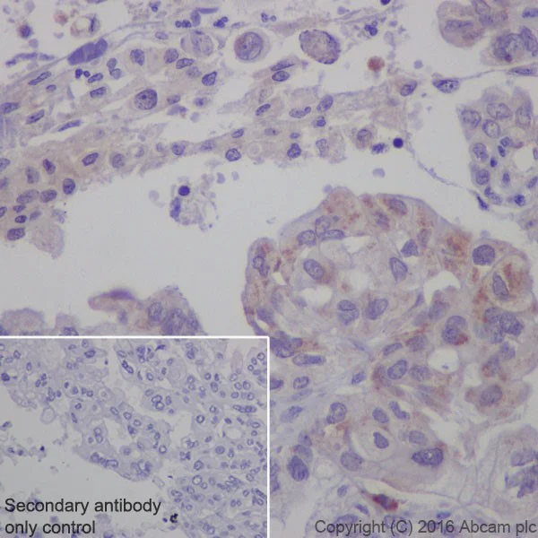 Immunohistochemistry (Formalin/PFA-fixed paraffin-embedded sections) - Anti-Cathepsin K antibody [EPR19992] (AB207086)