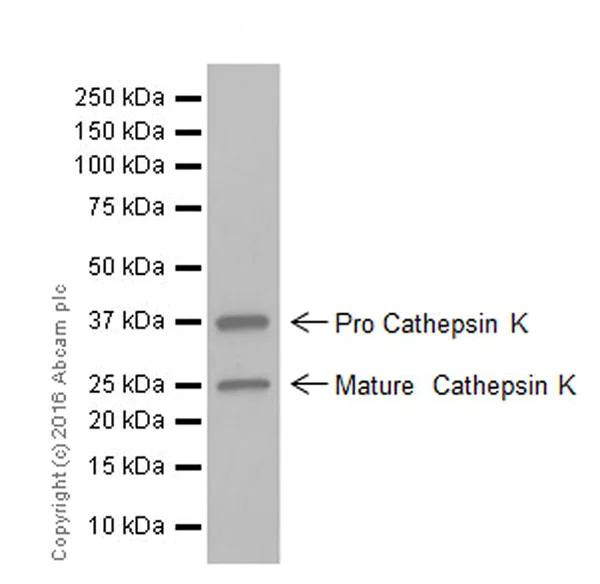 Western blot - Anti-Cathepsin K antibody [EPR19992] (AB207086)