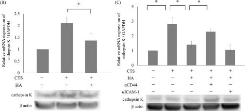 Western blot - Anti-Cathepsin K antibody [EPR19992] (AB207086)