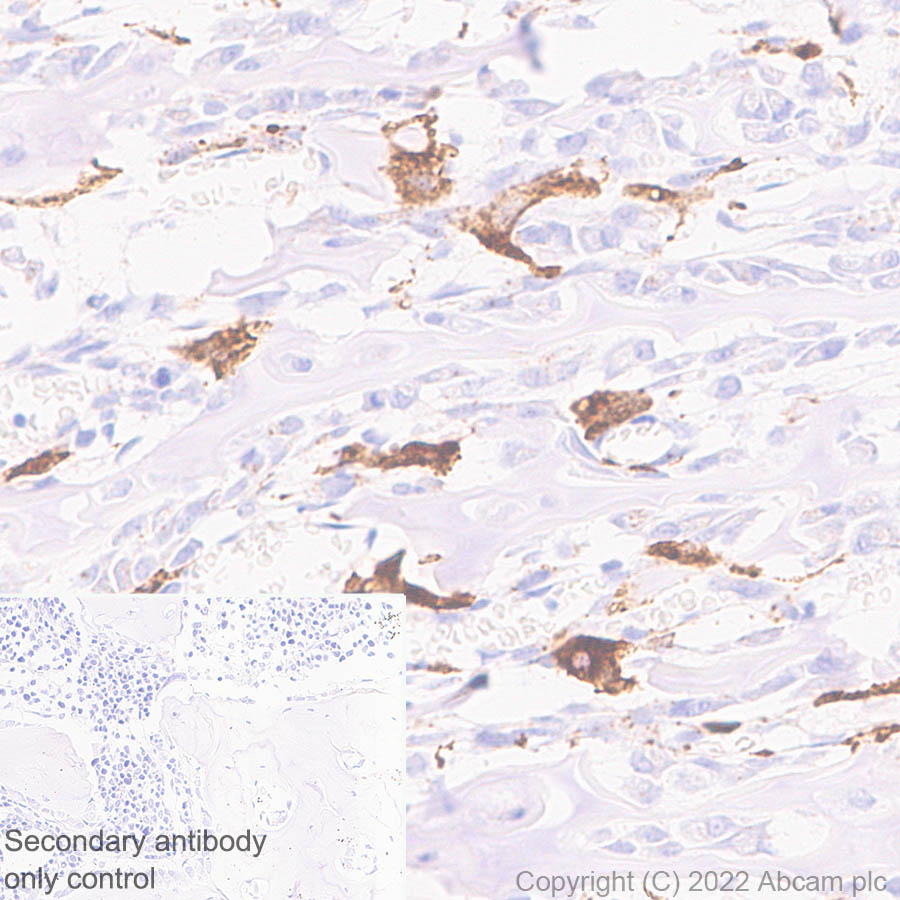 Immunohistochemistry (Formalin/PFA-fixed paraffin-embedded sections) - Anti-Cathepsin K antibody [EPR24829-101] (AB300569), expandable thumbnail