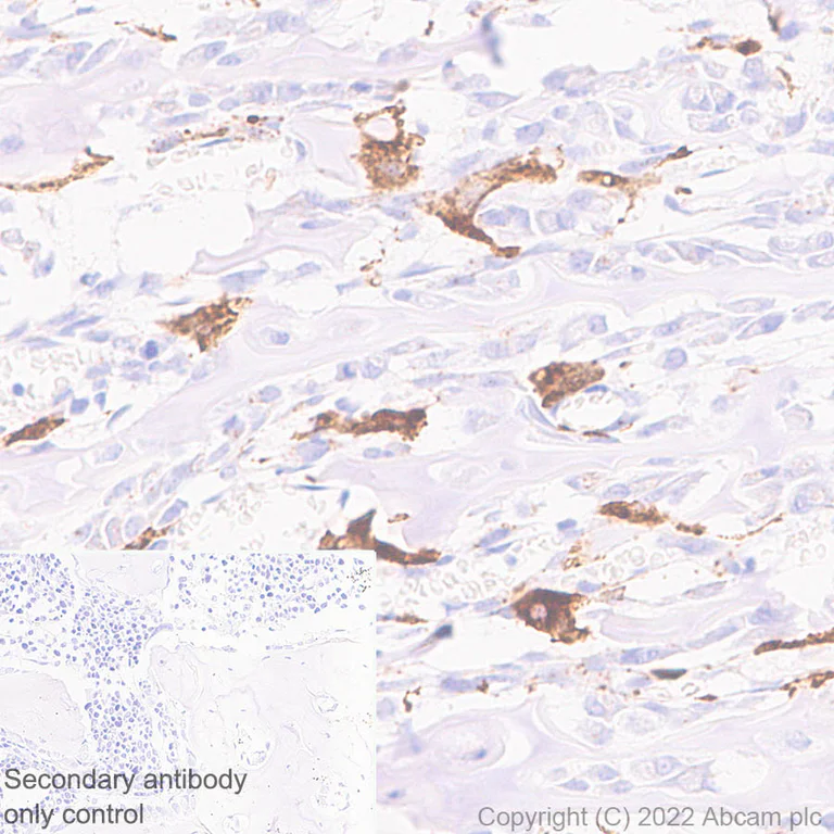 Immunohistochemistry (Formalin/PFA-fixed paraffin-embedded sections) - Anti-Cathepsin K antibody [EPR24829-101] (AB300569)