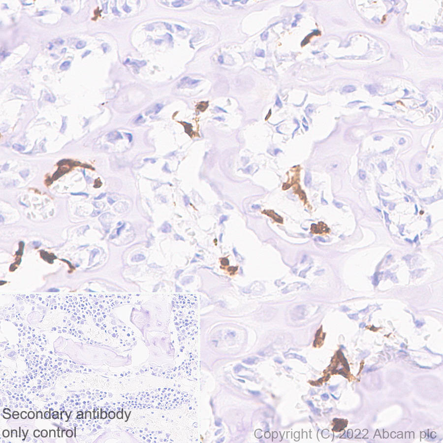 Immunohistochemistry (Formalin/PFA-fixed paraffin-embedded sections) - Anti-Cathepsin K antibody [EPR24829-101] (AB300569), expandable thumbnail